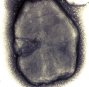 cristal bacillus thuringiensis